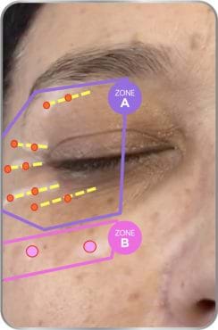A_B_eye_zone